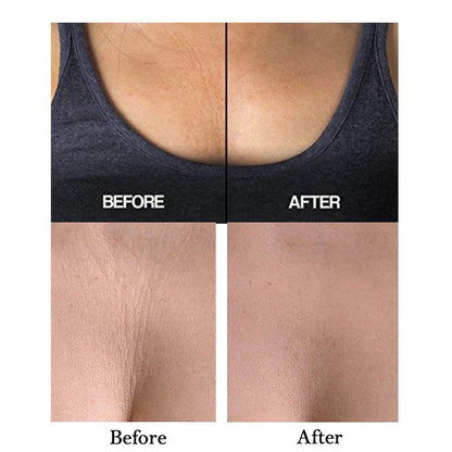 silicone chest wrinkle patch