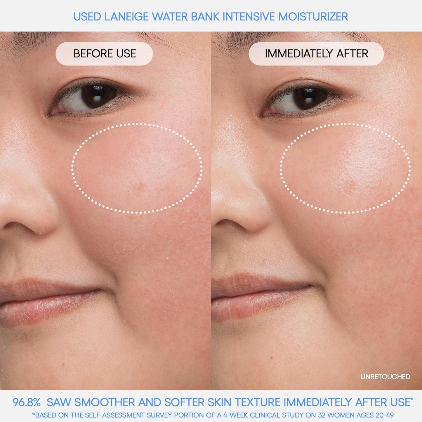 Water Bank Blue Hyaluronic Intensive Moisturizer: Hydrating Face Cream for Extra Dry Skin with Squalane & Peptide for Skin Barrier Support, Dermatologist - Tested - Born this WayWater Bank Blue Hyaluronic Intensive Moisturizer: Hydrating Face Cream for Extra Dry Skin with Squalane & Peptide for Skin Barrier Support, Dermatologist - TestedBorn this WayBorn this Way