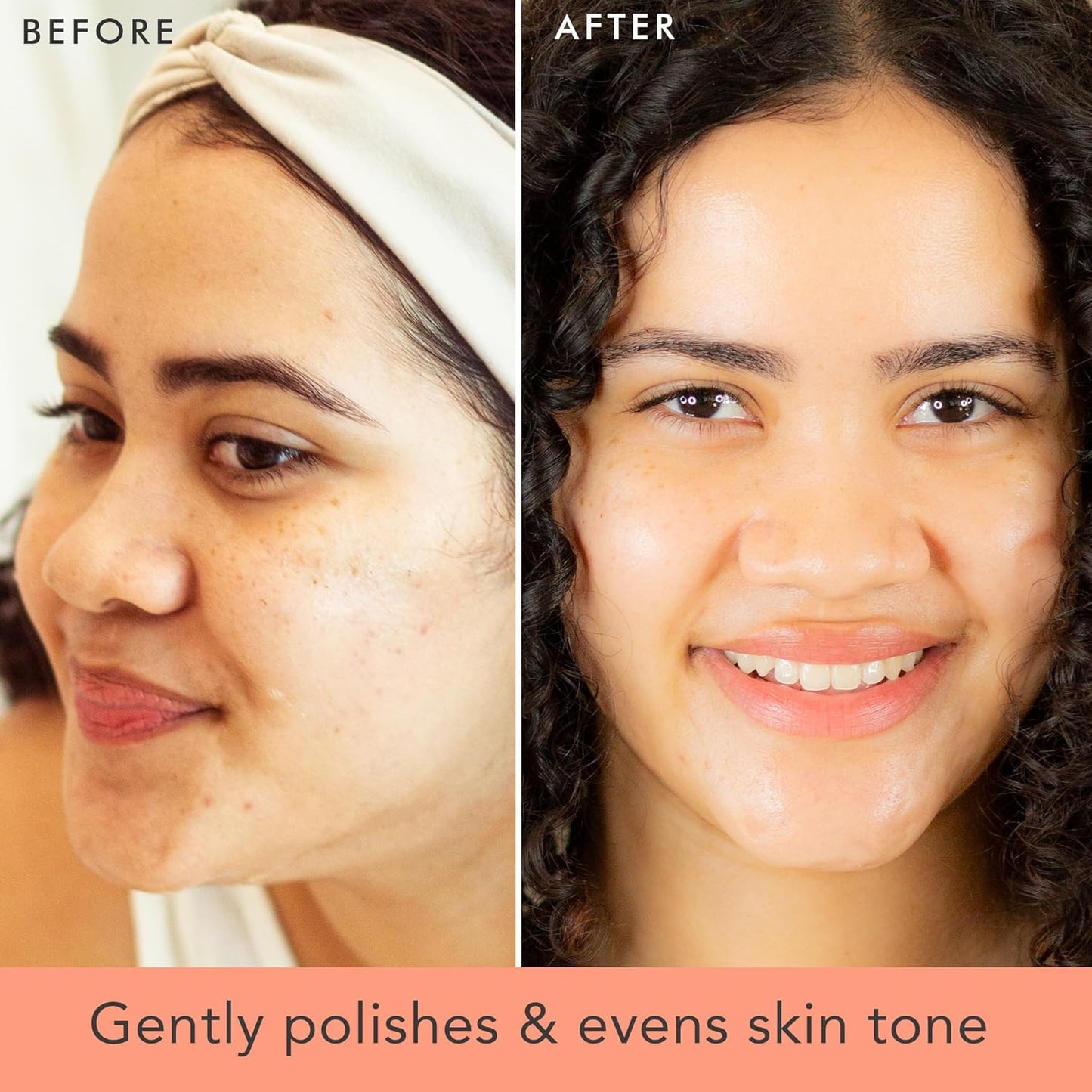 Professional Exfoliating Face Scrub - USA - Made with Natural & Organic Ingredients for All Skin Types, Microdermabrasion Formula with Glycerin to Gently Cleanse and Remove Dead Skin Cells - Born this WayProfessional Exfoliating Face Scrub - USA - Made with Natural & Organic Ingredients for All Skin Types, Microdermabrasion Formula with Glycerin to Gently Cleanse and Remove Dead Skin CellsBorn this WayBorn this Way