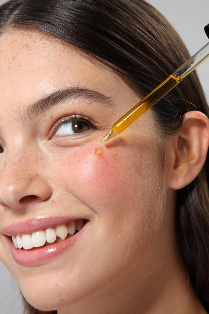 Organic Rosehip Seed Oil for Face, 100% Pure | Natural Cold Pressed Unrefined Non - Gmo | Carrier Oil for Skin, Hair & Nails - Born this WayOrganic Rosehip Seed Oil for Face, 100% Pure | Natural Cold Pressed Unrefined Non - Gmo | Carrier Oil for Skin, Hair & NailsBorn this WayMy Store