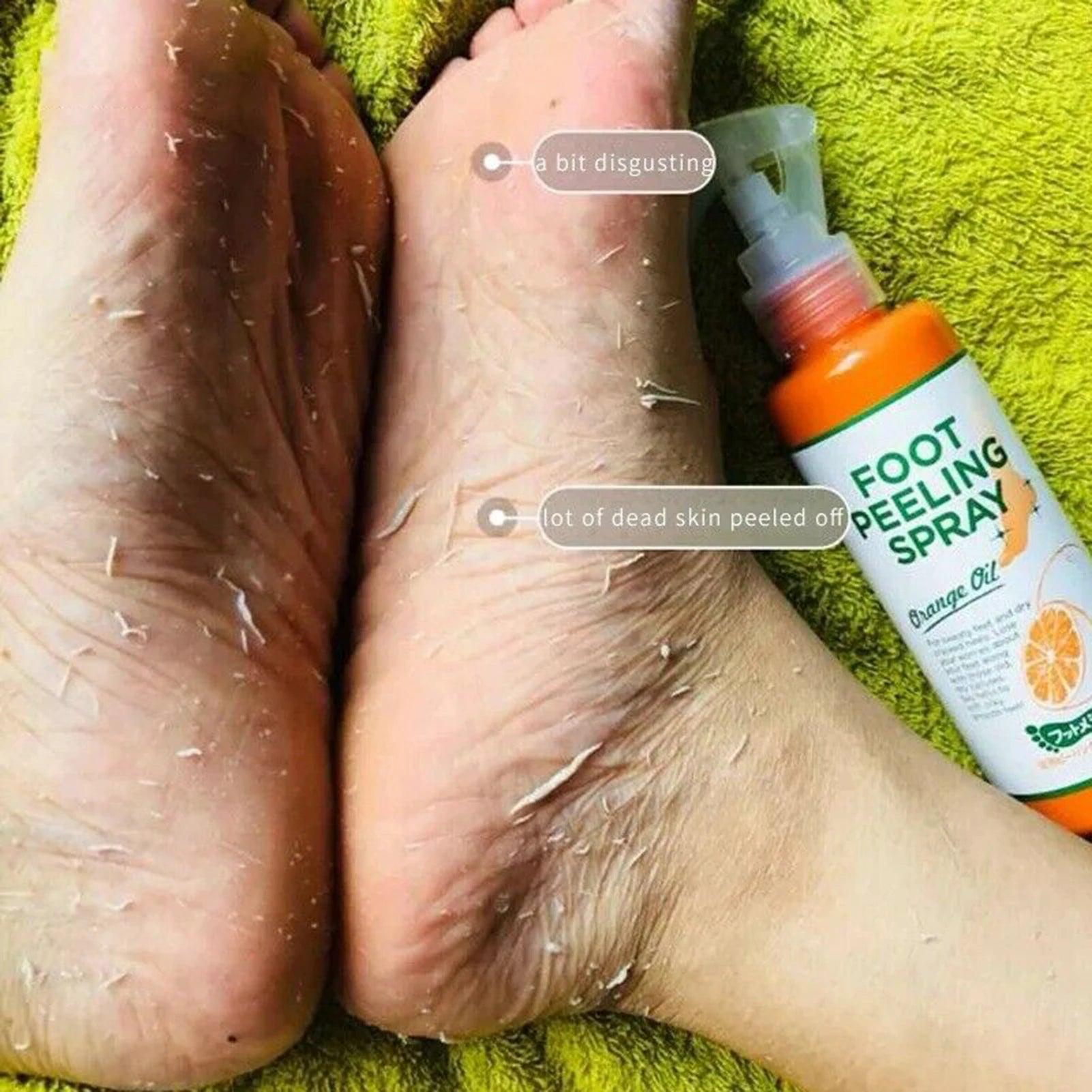 foot peeling spray