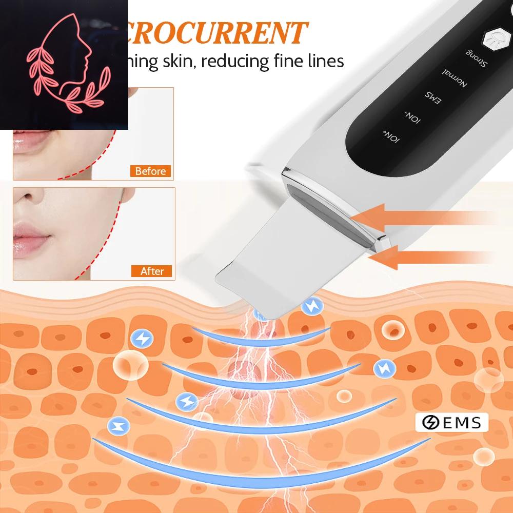 blackhead remover vacuum