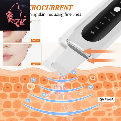 blackhead remover vacuum