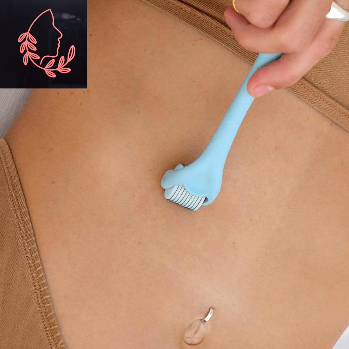 microneedle derma roller